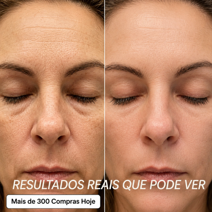 Transforme Rugas, Linhas Finas e Vincos de Expressão Cansados de Forma Natural