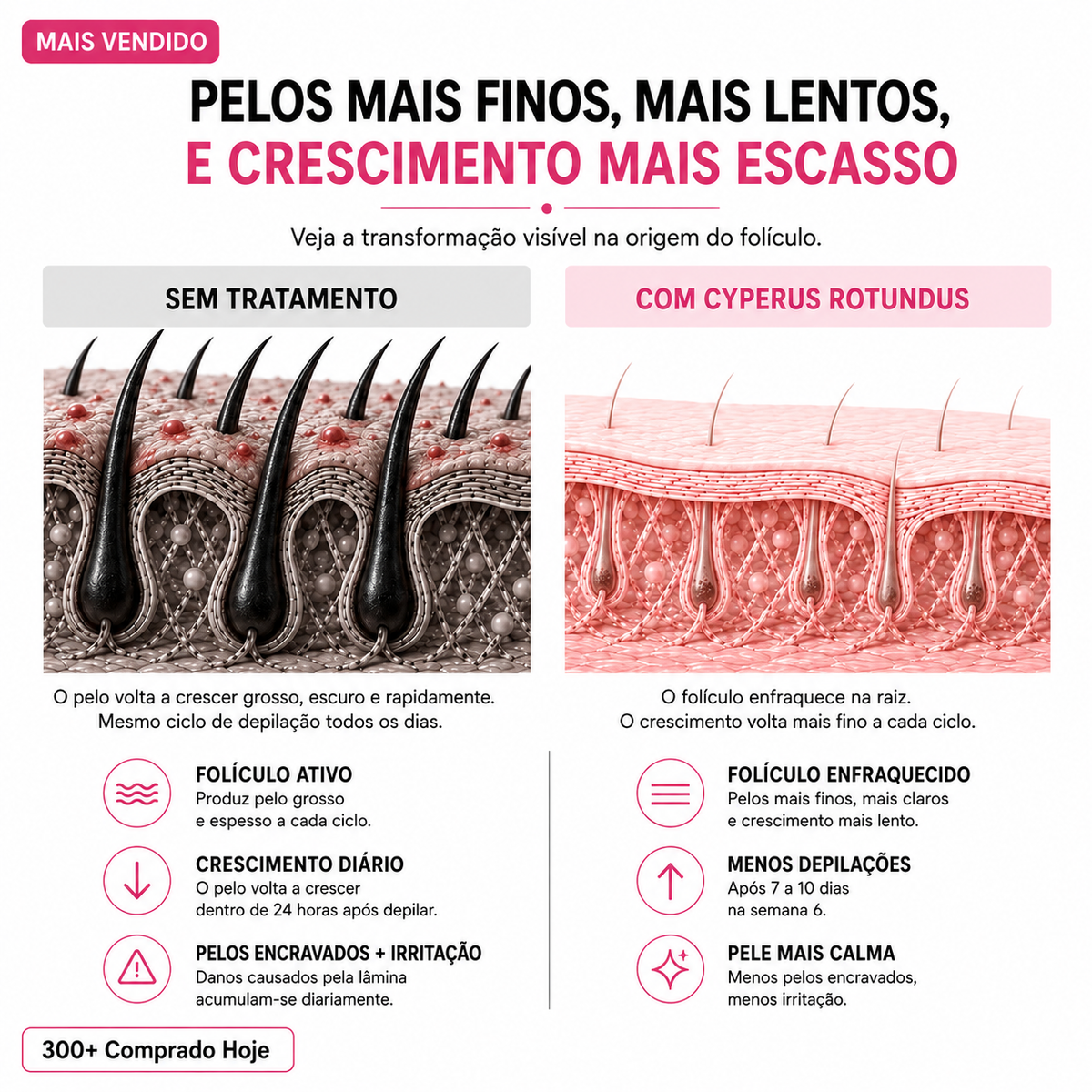 Óleo Inibidor do Crescimento dos Pelos