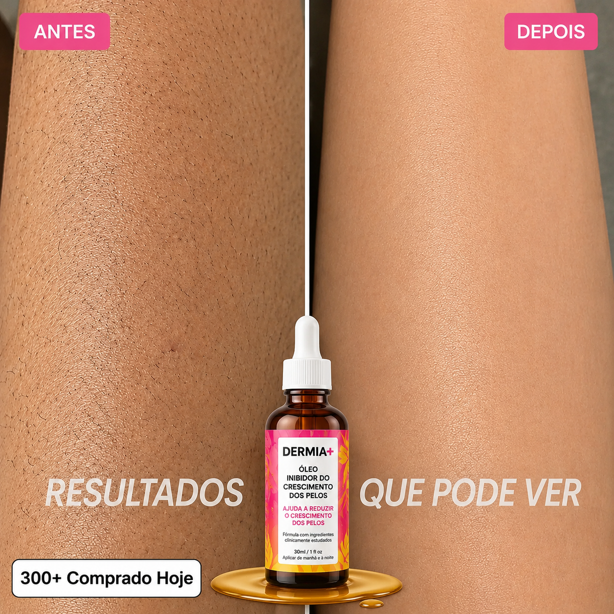 Óleo Inibidor do Crescimento dos Pelos